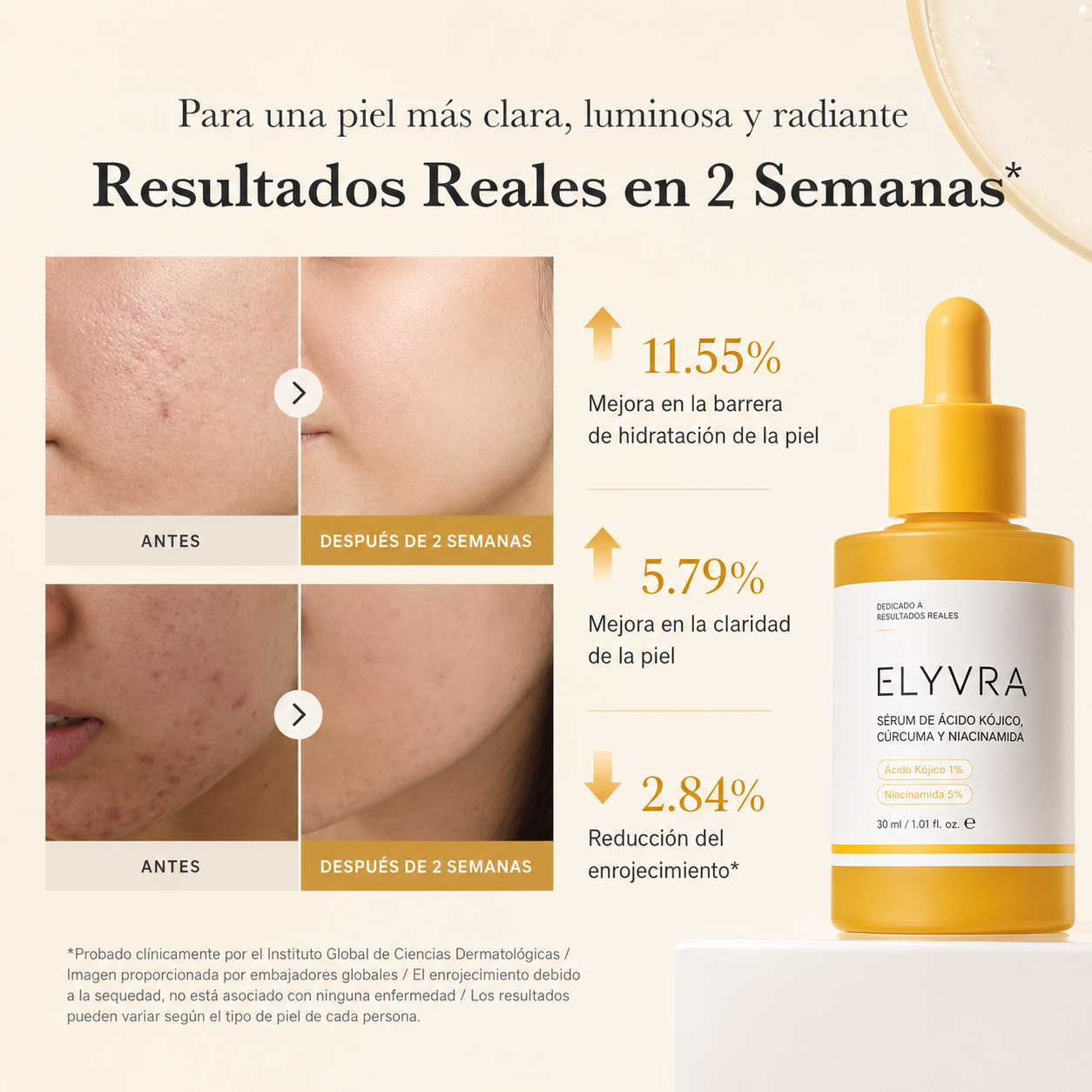 Sérum Eliminador de Manchas Corporales | ELYVRA
